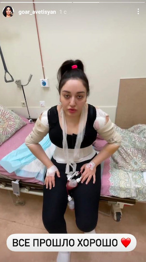 Гоар отошла от наркоза и пошла к зеркалу