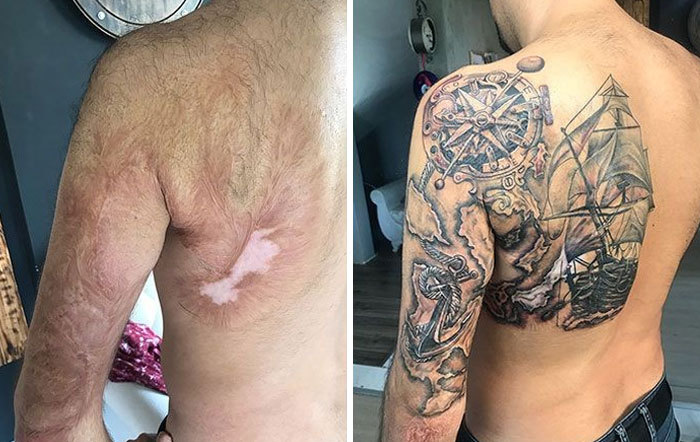 Когда каждая часть шрама включена в дизайн. Когда каждая часть шрама включена в дизайн.
