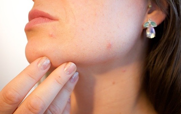 Эксперты назвали пищевые привычки, которые вредят коже